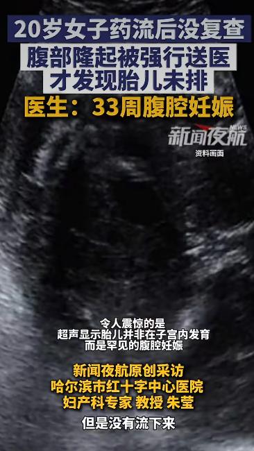 一位二十岁左右的年轻女孩因为意外怀孕，自己偷偷买了流产药服用，本以为吃完药就万事