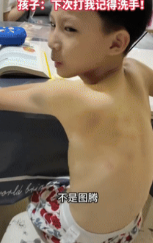 代价太大了！”北京一男孩放暑假玩“疯”了，作业基本没动，电视一看就是半天，妈妈实