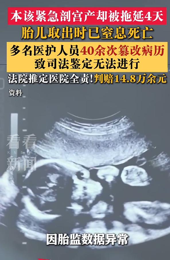 成都，孕妇产检胎监不正常，住进了医院。本该及时剖腹产，结果硬生生拖了4天，导