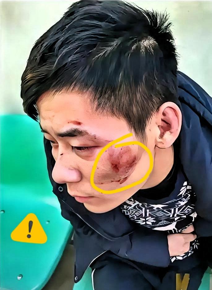 凌晨惊魂一幕！男子街头遭追打，直奔武警营门寻庇护！近日凌晨，四川街头上演