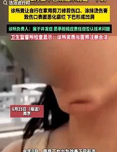“自作孽不可活！”南京女孩去美容院“打薄下巴”，不料美容院却失误将她的下巴消融了