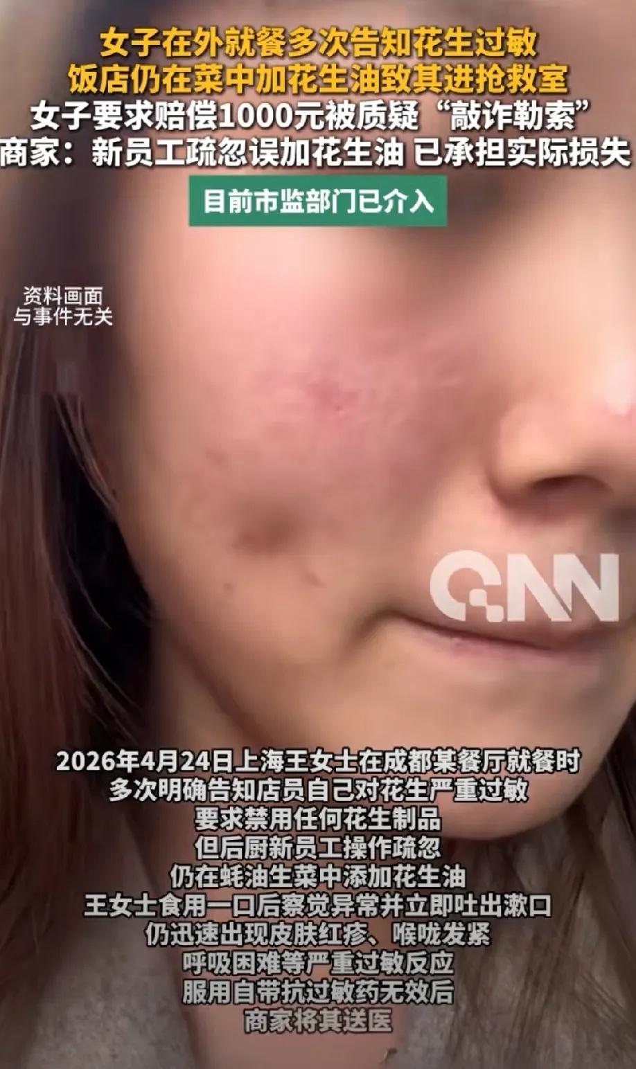 四川成都，一名女子一家网红餐厅吃饭，再三叮嘱餐厅自己对花生过敏，不要用花生油做菜