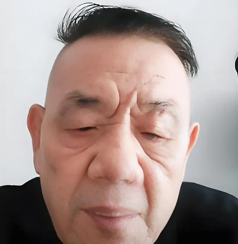 杨进明解释：杨少华葬礼之上，身为干儿子的自己为何佩戴孙子辈红绒球？昨日，杨少
