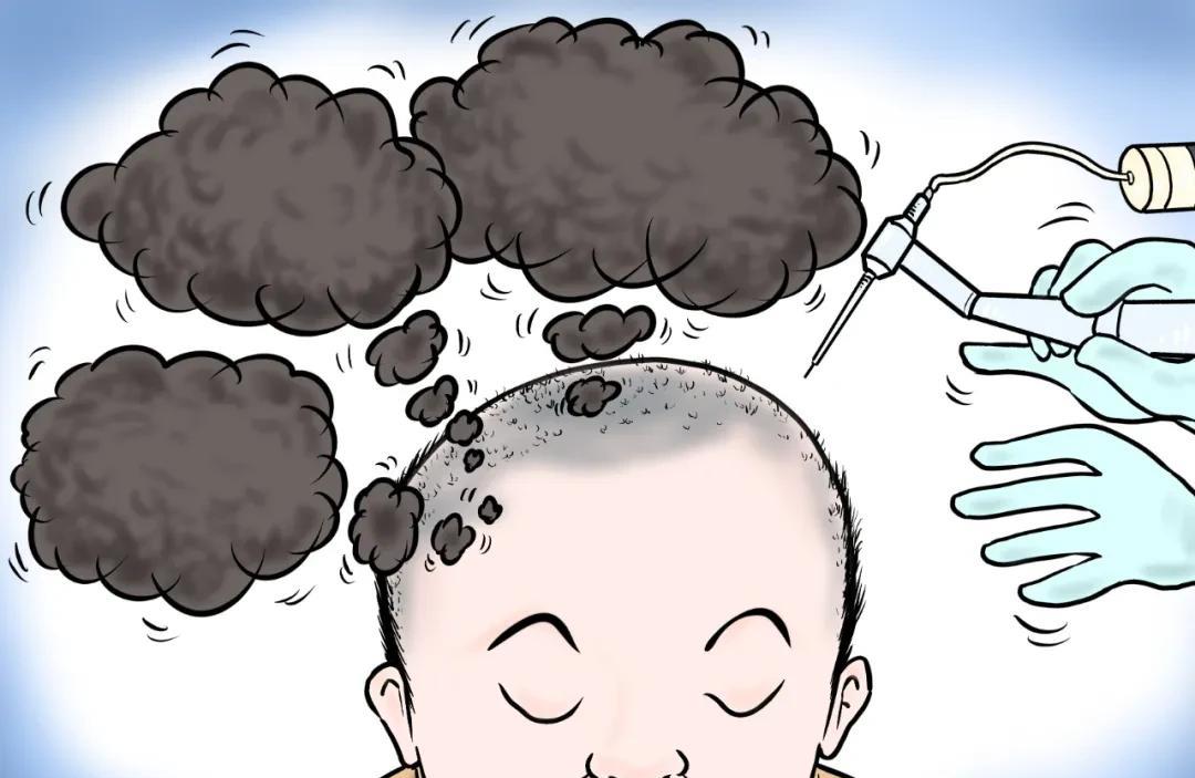 湖北大冶，刘某在花9880元做了生发项目，两个月后发现头发没长出来，于是要求美容