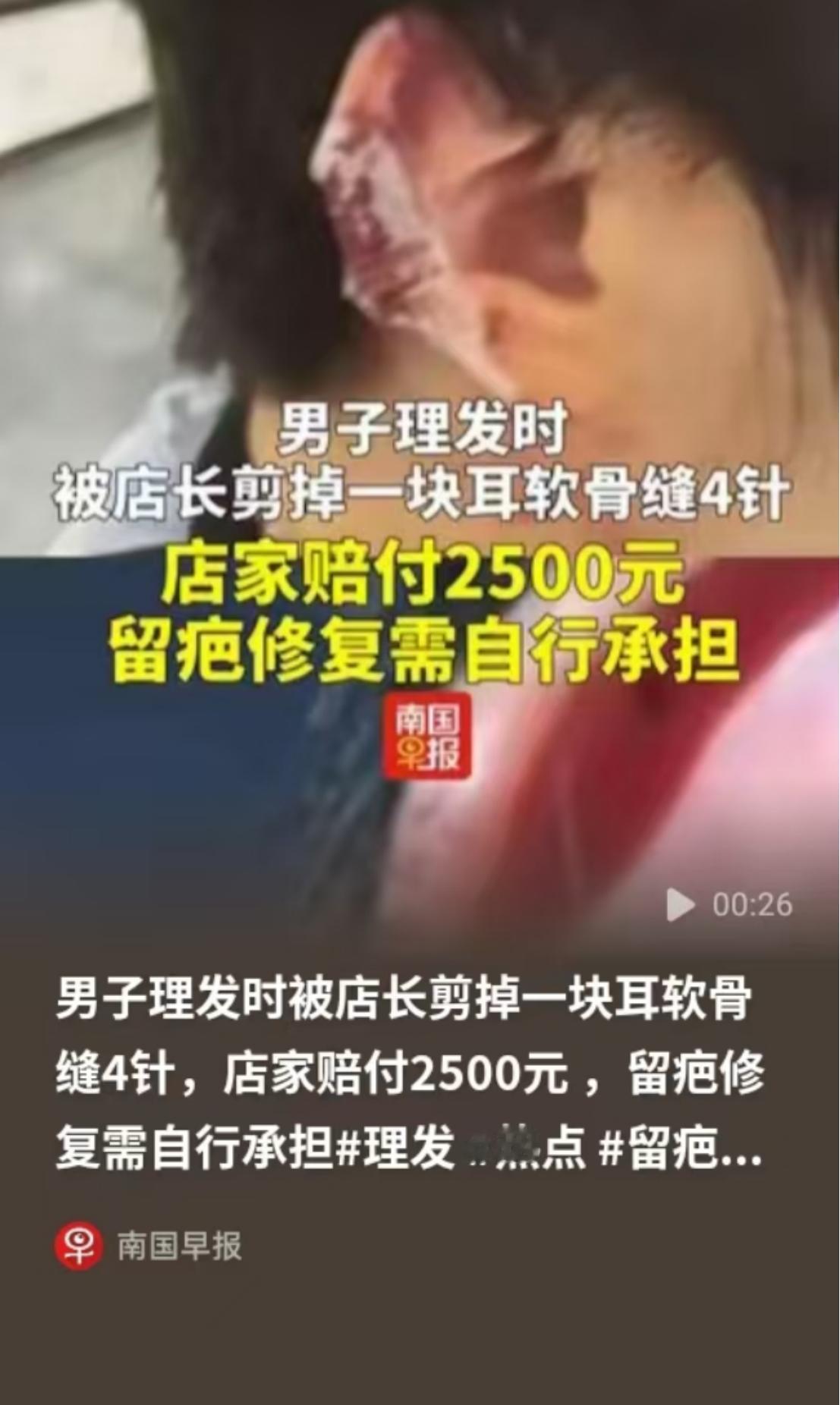 剪个头发，结果耳朵缝了4针！8月23日，湖北黄冈一名男子到理发店剪发，店长操作时