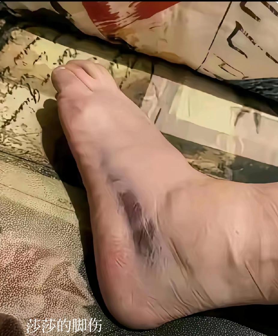 看一次心疼一次！孙颖莎带伤拼搏的样子太戳人盯着图里莎莎脚上的伤，再看她忍痛