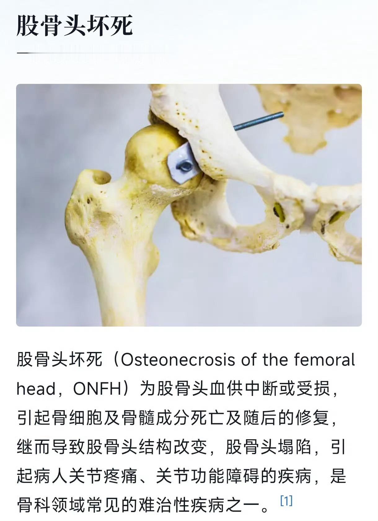 刘欢什么病一定要好好爱惜自己的身体！首先你要健康，其次都是其次。刘欢老师，一路走好！​​​
