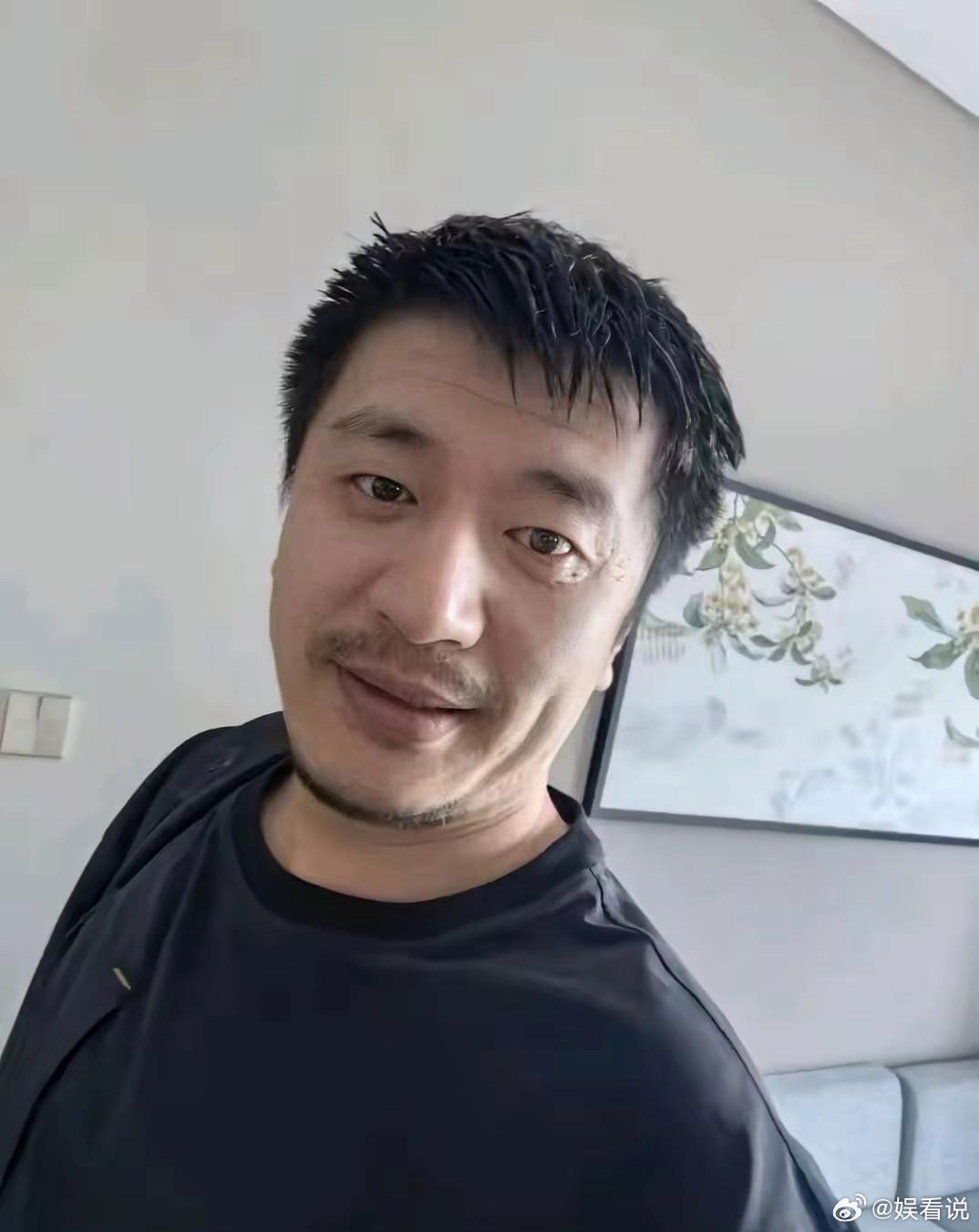 张雪峰这两张照片看着身体就不是很好了！从眼神里，看出，他好累啊。