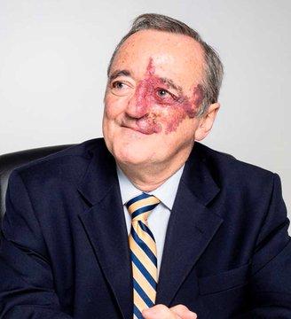 西班牙科学家研发出一种疗法，可以彻底消除实验小鼠的胰腺癌。1月27日，西班牙