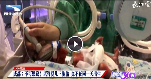 试管婴儿怀上三胞胎顺产生了一个隔两天又剖了两个