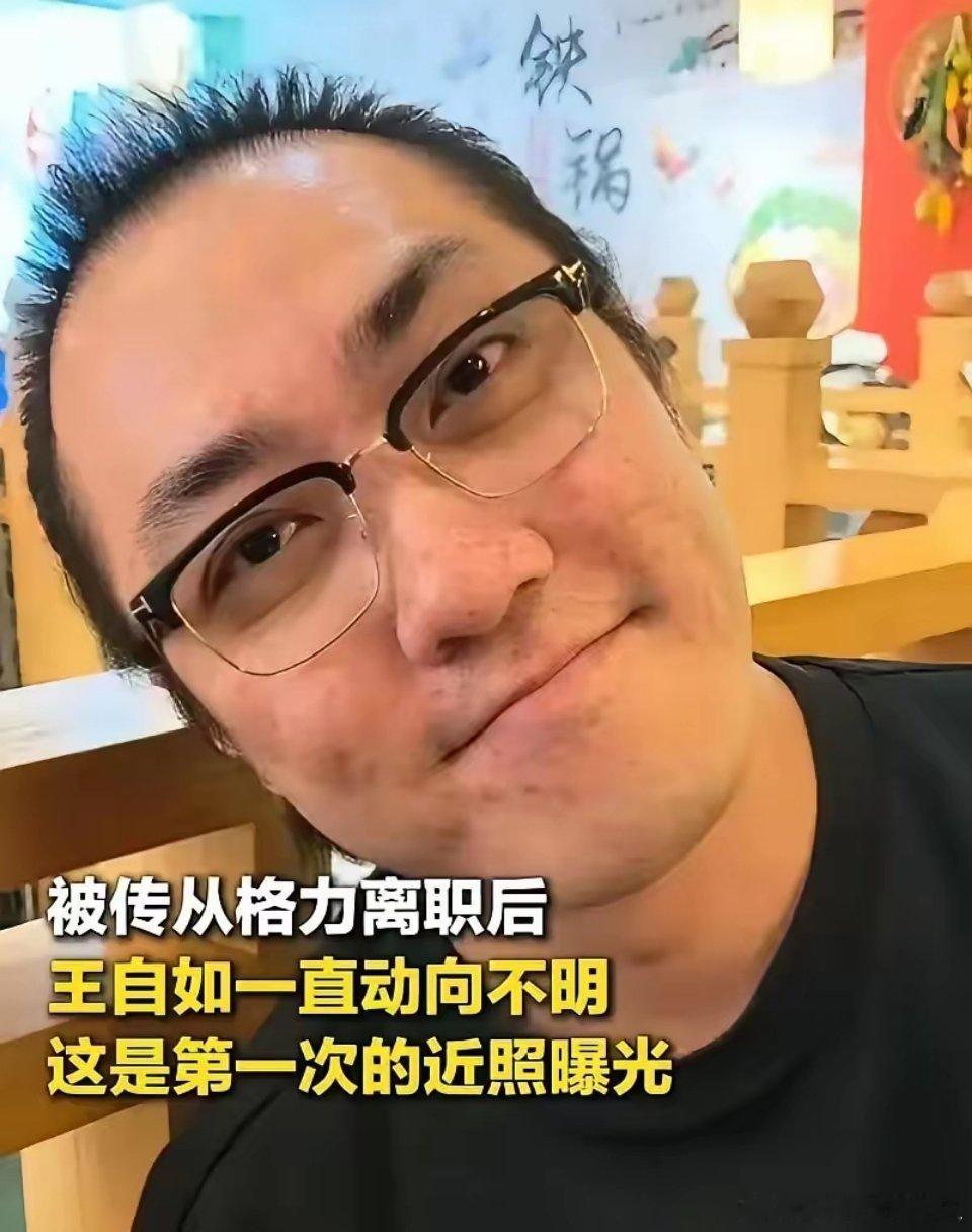 王自如怎么成秃子了？？？