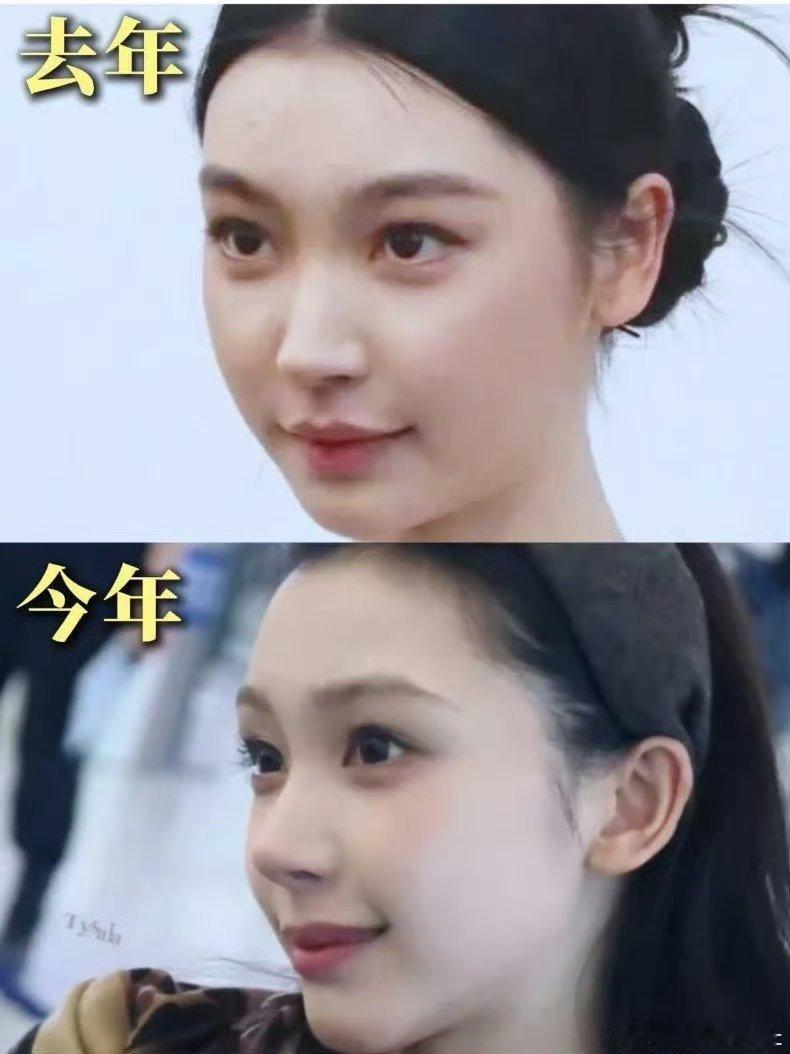 易梦玲脸上做了线雕？感觉她一直在进步，大家以前说她美妆蛋，现在开始有骨相感了