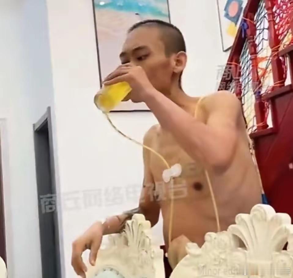 2023年，有个肝癌晚期的男子，放弃治疗后买了箱啤酒。他光着膀子插着管子，对着啤
