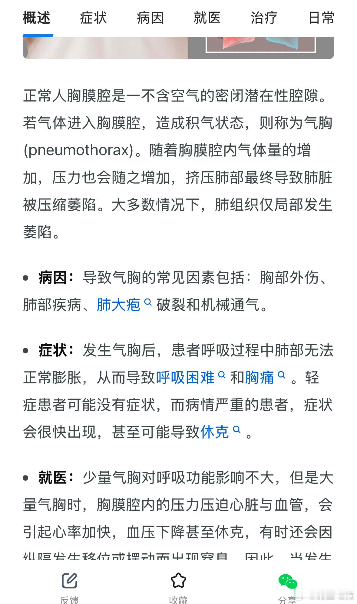 为什么高瘦男性容易得气胸在我读高中的时候，那个时候就是高高瘦瘦，喜欢运动，记得