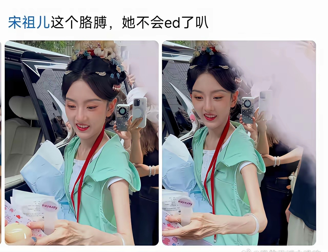 宋祖儿镯子都滑到大臂了，她真不饿吗？