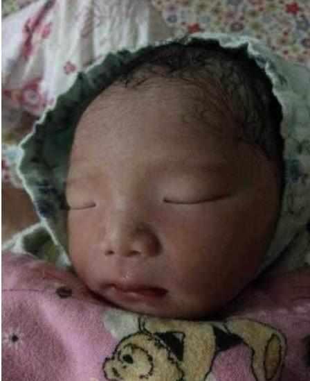 婴儿出生几天没睁开眼, 婆婆用手掰开
