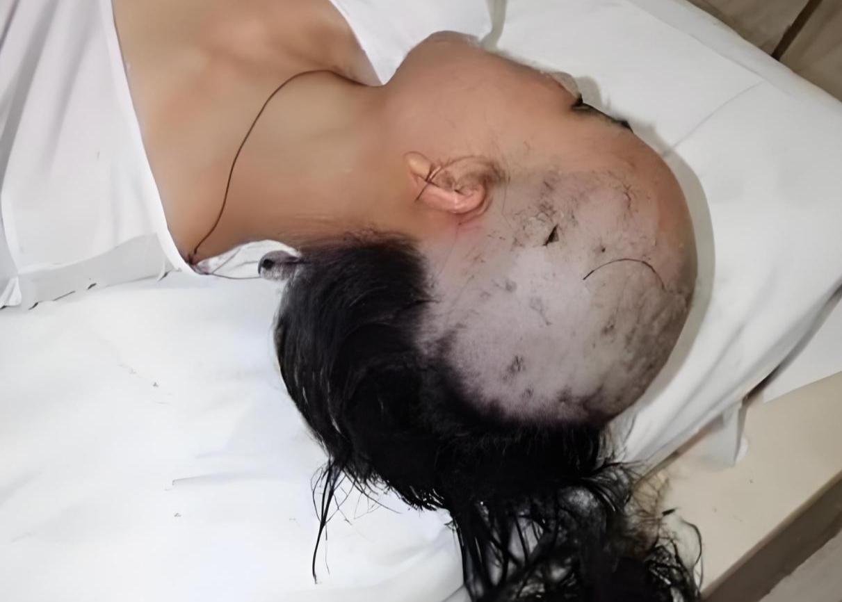 他第一次打我，我没报警。趁他睡着，我拿推子把他头发剃了个精光，眉毛也没留。第二