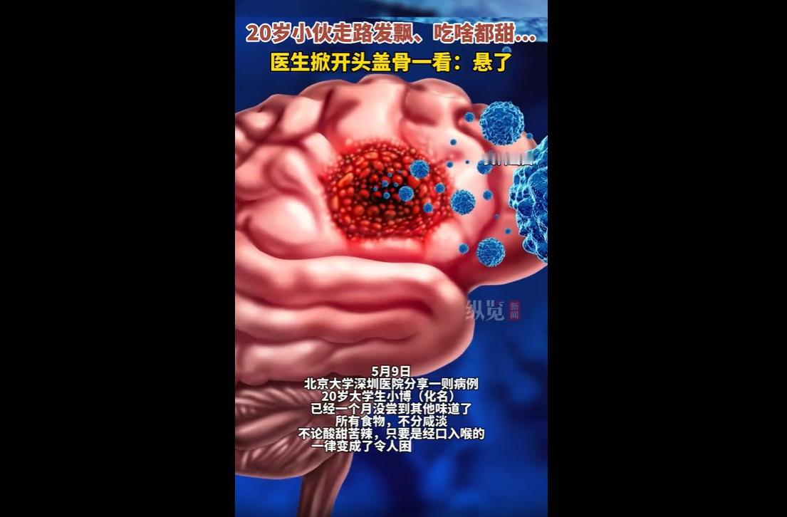 近日，北京大学深圳医院接诊了一则典型病例。20岁大学生小博持续一个月出现味觉异