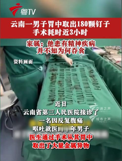 解释不清了！云南一男子因腹痛、呕吐送医，检查发现腹中竟密密麻麻全是金属异物，总重