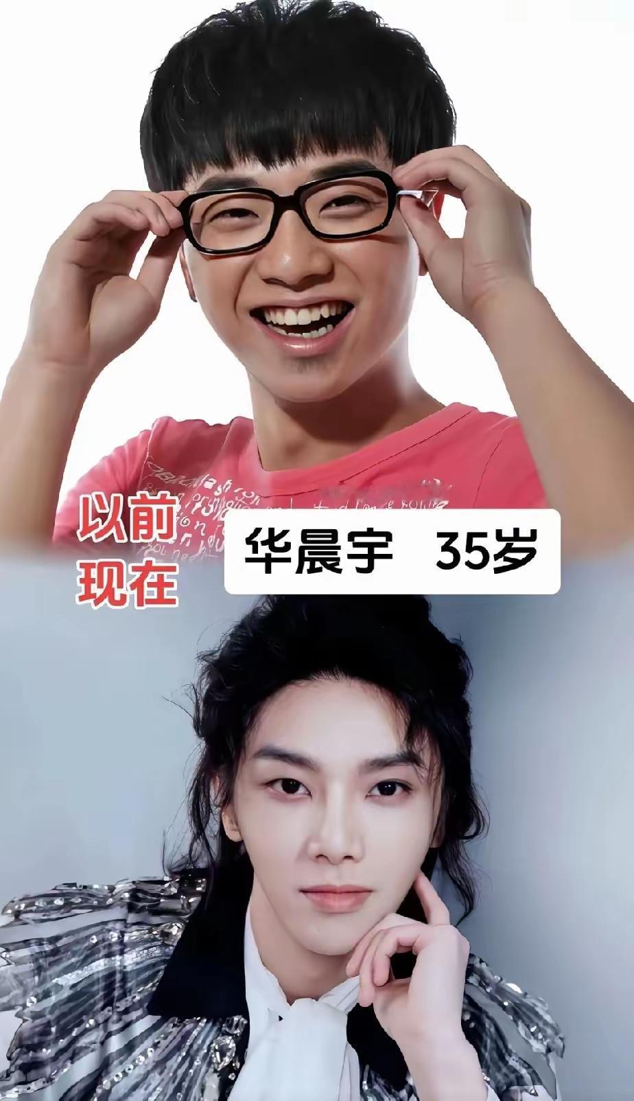 男明星出道前后颜值的变化，你觉得谁的变化最大呢？在我看来，毫无疑问，就是赵荀了，