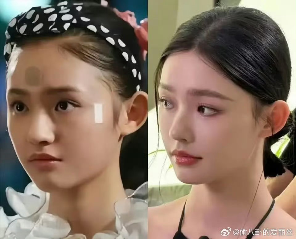 正常表情的时候哪里丑了不懂为什么那么多人说她早期丑