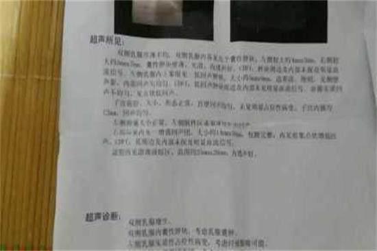 看完这篇文章, 我不信你还看不懂“乳腺增生报告单”