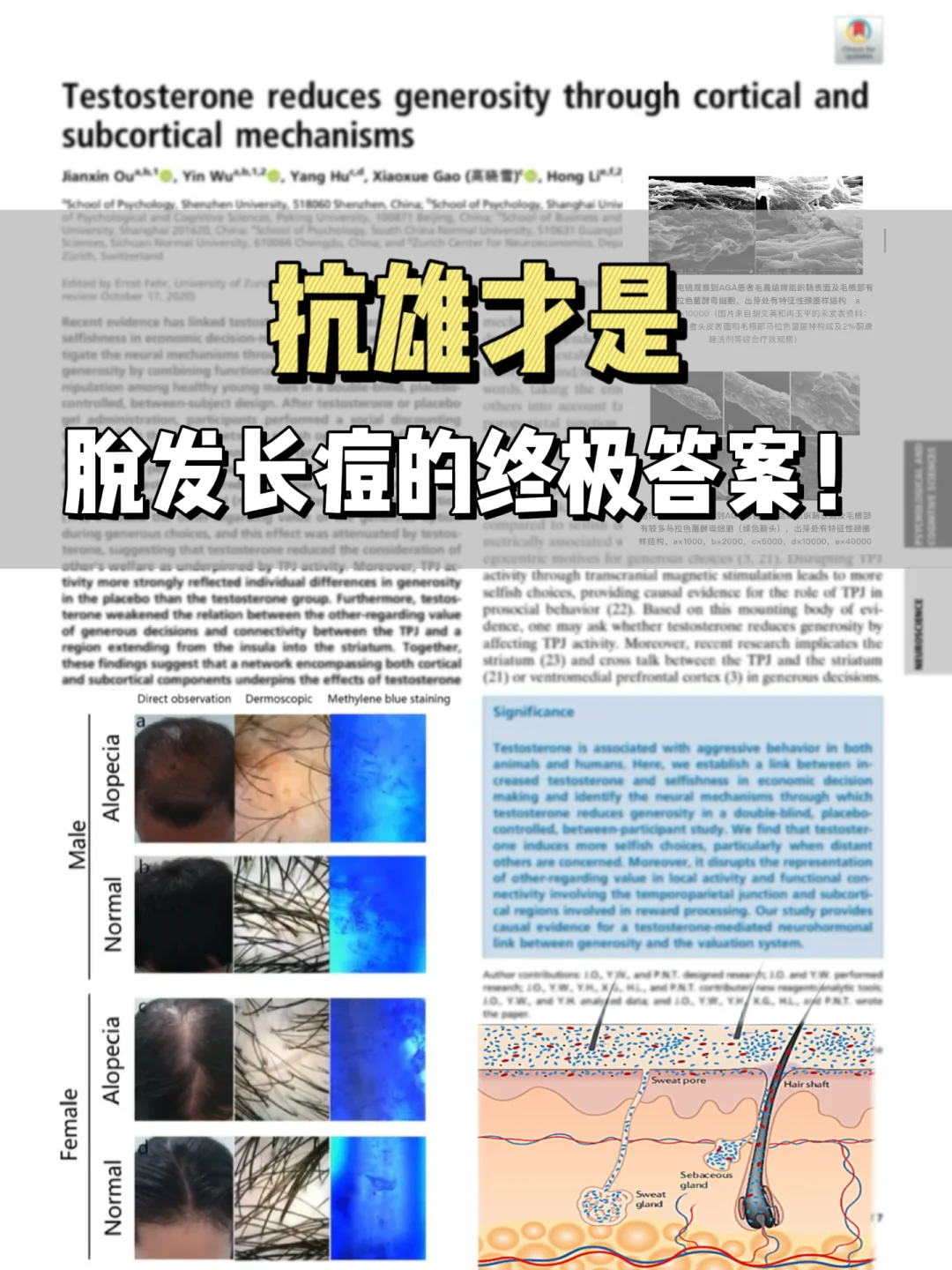 抗雄才是脱发长痘的终极答案！