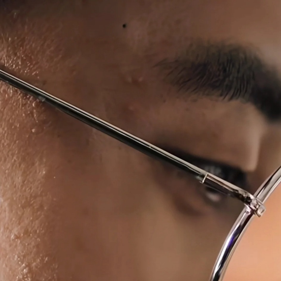 王天辰这颗黑头谁去挤？？？真的很想冲进屏幕里