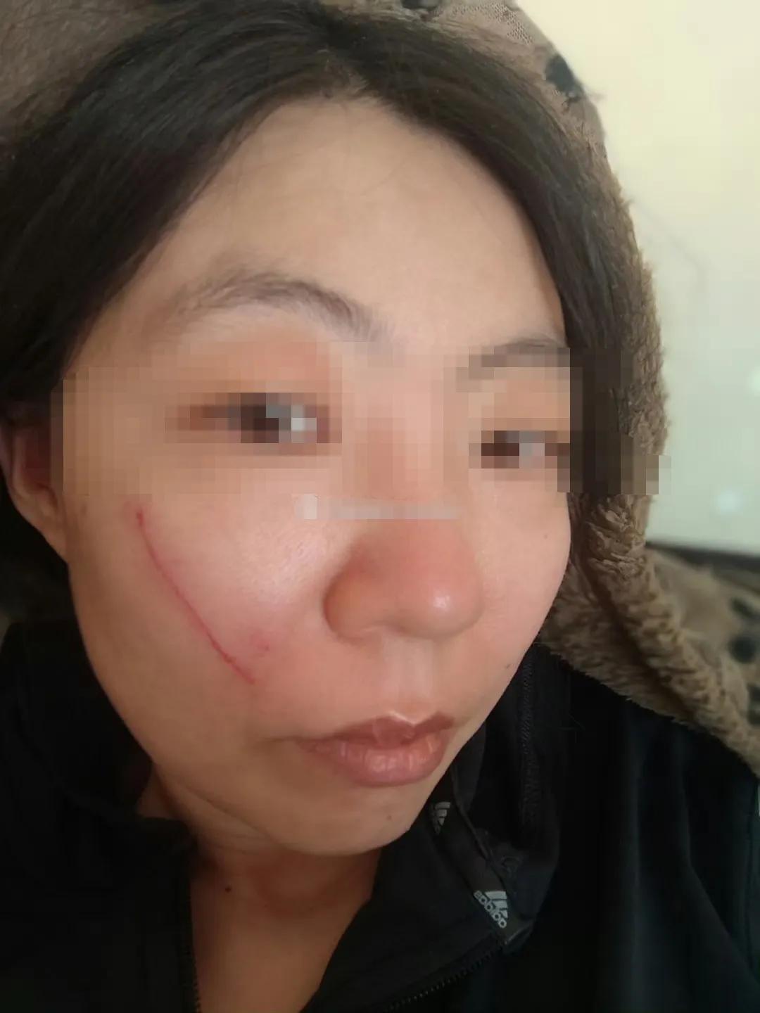 不可思议、匪夷所思，这个女人说她为了爱情嫁到阿富汗，结果………