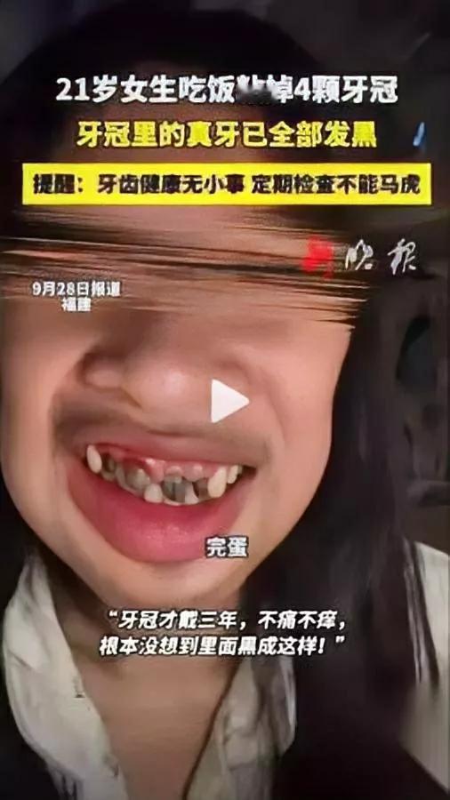 21岁女生牙冠崩了！张嘴一看当场吓懵……福建这位姑娘戴了3年的牙冠突然脱