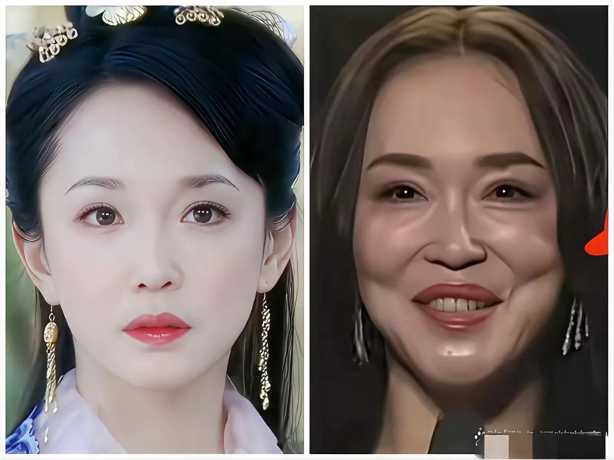 素颜的她们本来长相甜美气质如兰，不知道为什么一整变得这样收看了呢？她们的变化。
