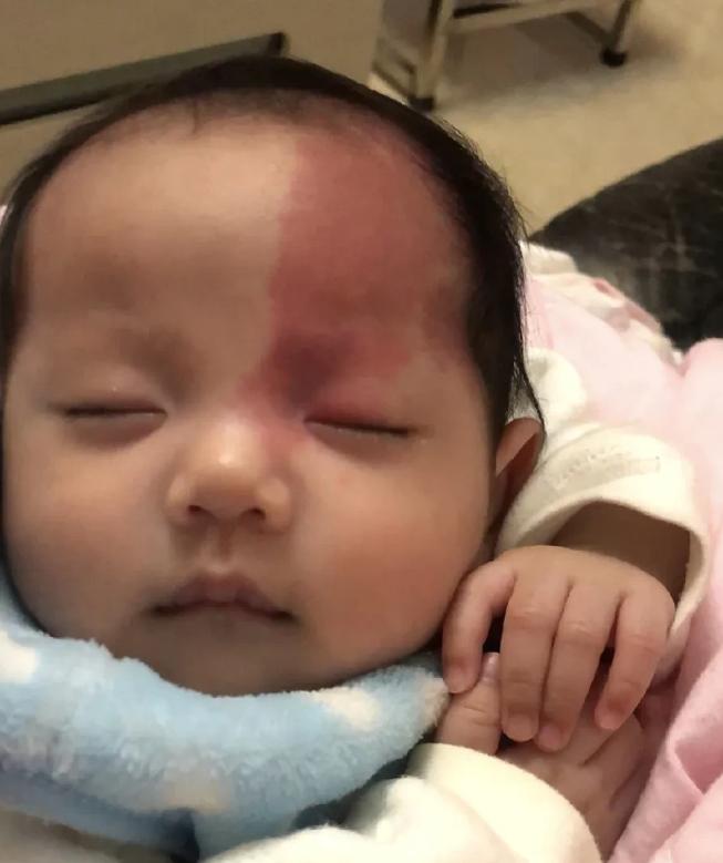 满心心酸！宝妈孕期产检时，就查出宝宝脸上疑似有胎记，宝爸执意让打掉，宝妈心疼