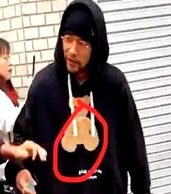 我问了骨科医生朋友，周杰伦的强直性脊柱炎到底有多严重。医生边翻病历边叹气："你