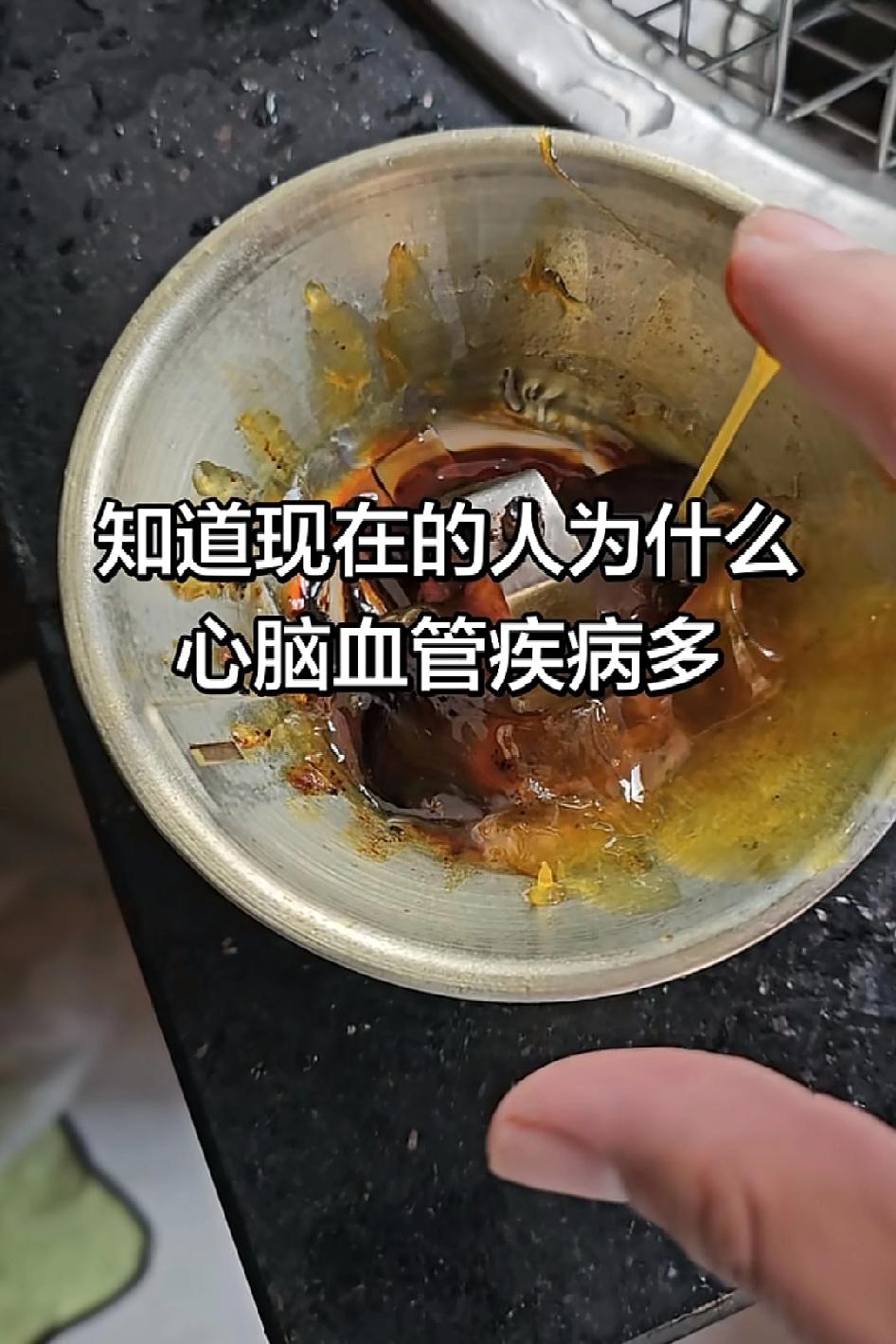 知道现在的人为什么心脑血管疾病多，时间久都成胶了，以后吃猪油吧，以前的人都吃猪油