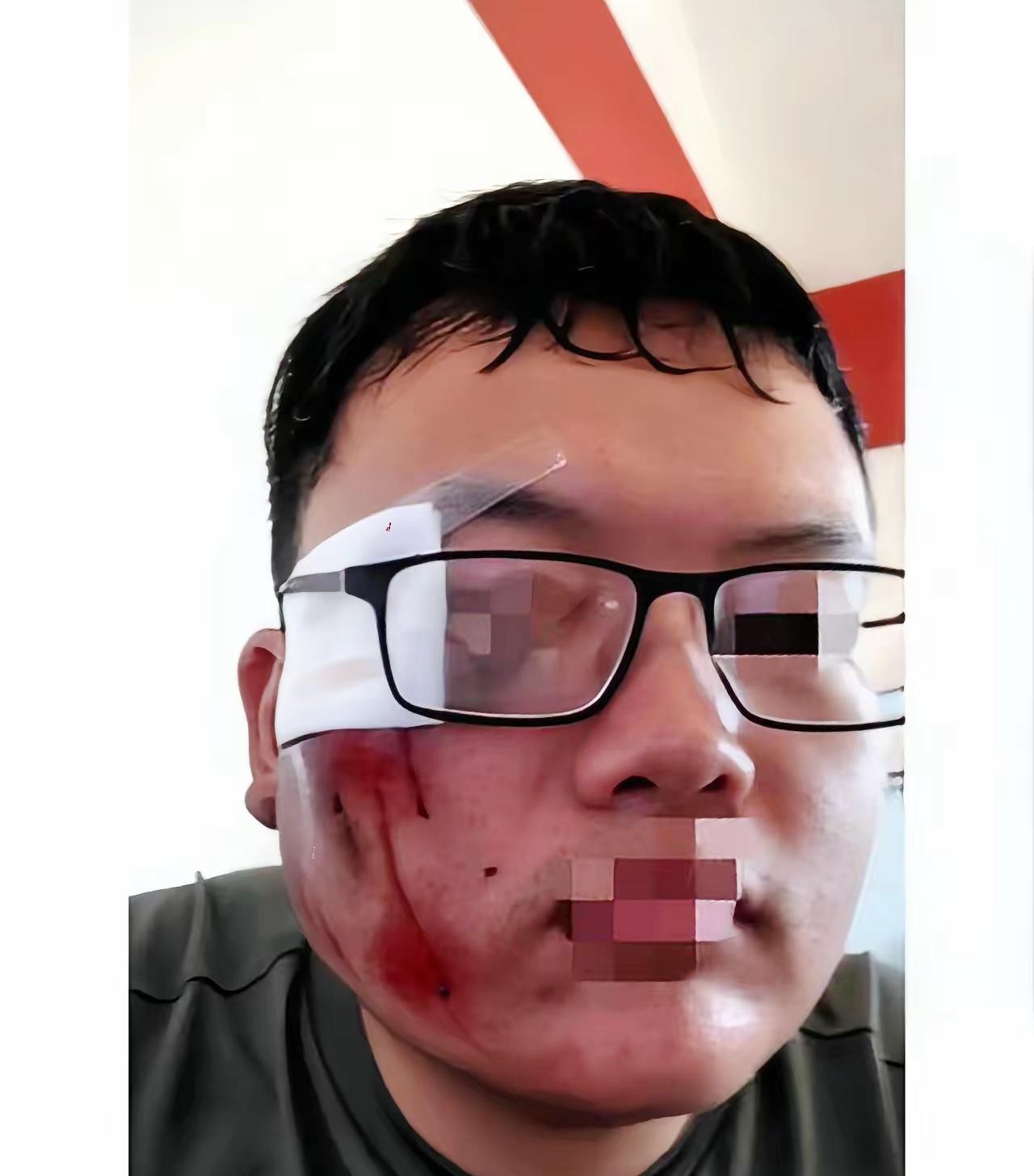 他拒绝了1000块封口费，坚持罚了对方2000，几天后，他躺在地上才懂：自己罚人