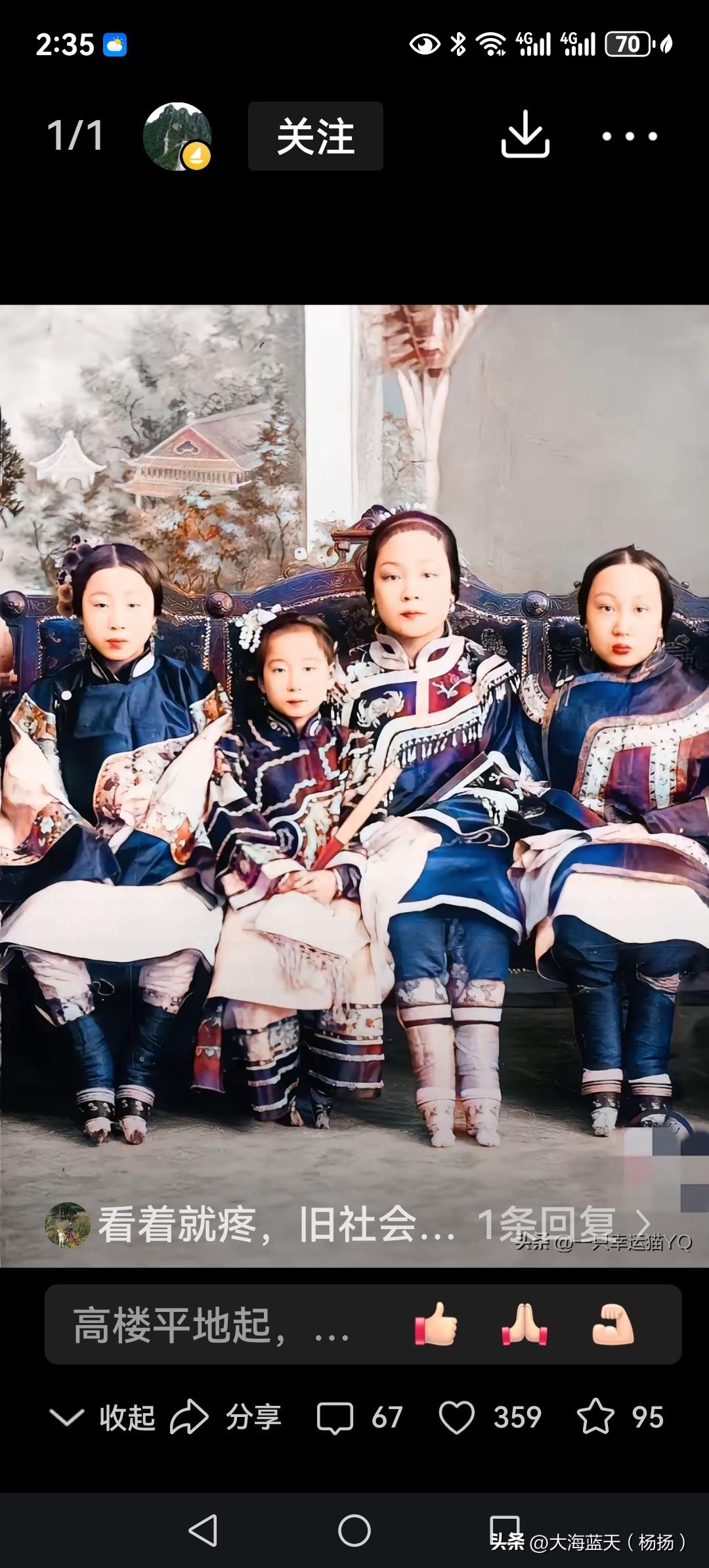 旧时代的产物那个年代咱们的奶奶都是两只三寸金莲，走路脚后跟用力，都是外八字，这