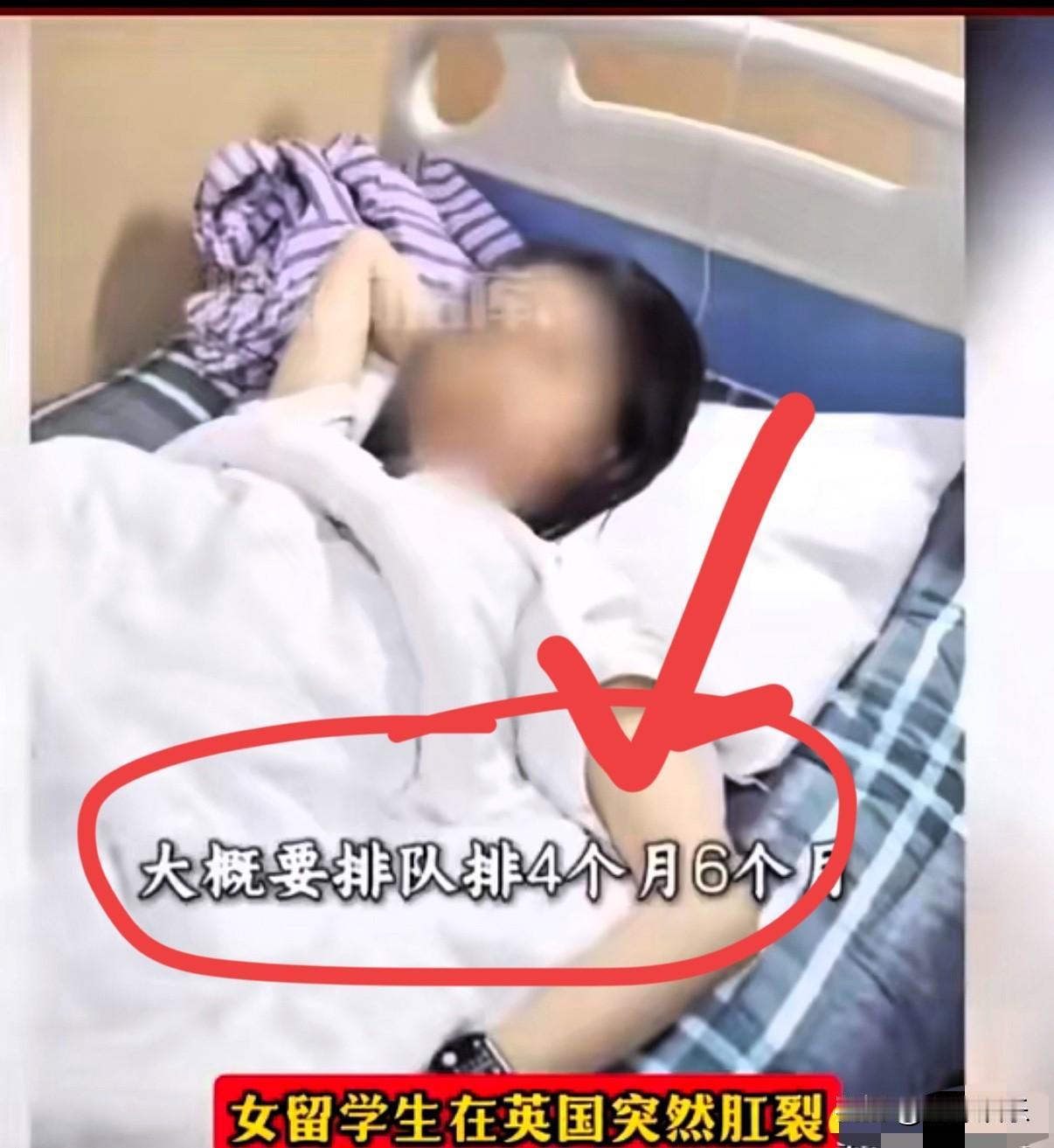 留学生夸英国医疗，转头因肛裂回国手术！评论区跑偏了有个在英国的女留学生，之