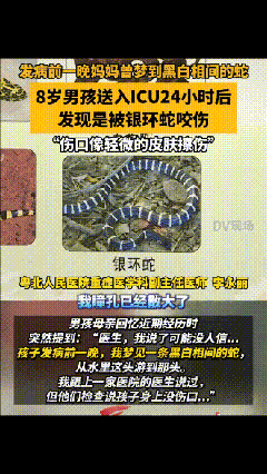 “连医生都解释不清了”！8岁男孩被银环蛇咬伤送进ICU抢救，到医院时已陷入深度昏