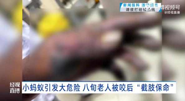 “悲剧还是发生了！”2025年7月，福建莆田，一老人在地里摘花生时，左手被
