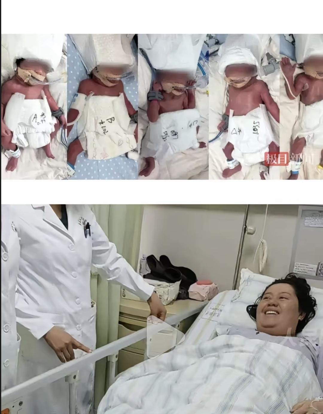 2月26号，新疆姑娘迪丽在武汉生下五胞胎，最小的才870克，早了两个月。五个小家
