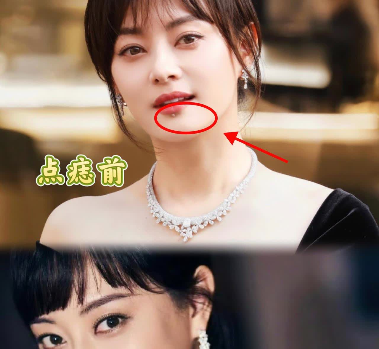 孙俪把唇下痣切了，不是因为怕影响颜值。这颗痣并非天生，