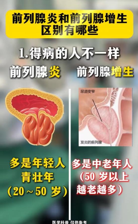 小腹坠胀疼痛、夜尿排尿费力？一文看懂炎症与增生的核心差别