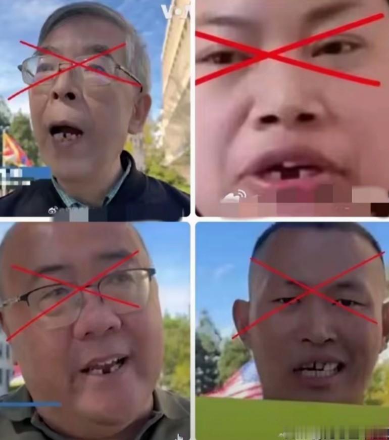 这四位润到米国去的名人。都同样掉了牙齿，为什么呢？美国看牙医太贵了，根本去不