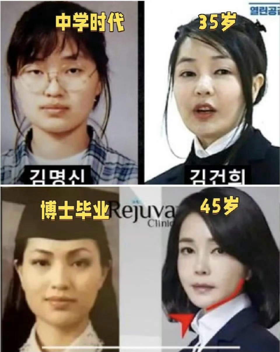 她的脸属于韩国的脸部科技技术展了吧！韩国前总统尹锡悦妻子