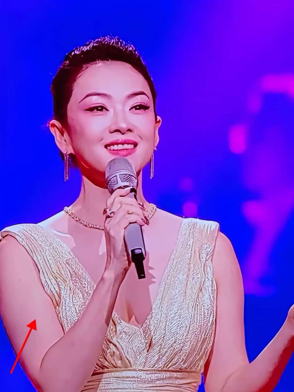 我闺蜜是做医美的，我拿着章子怡的照片问，她是不是做医美了吗？闺蜜看了眼照片说，
