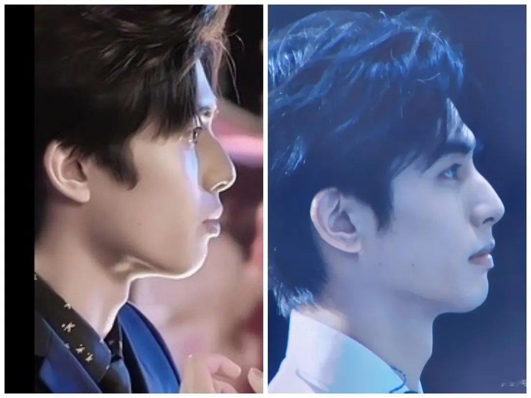 宋威龙真的没有微调过吗？怎么感觉和之前的脸不太像