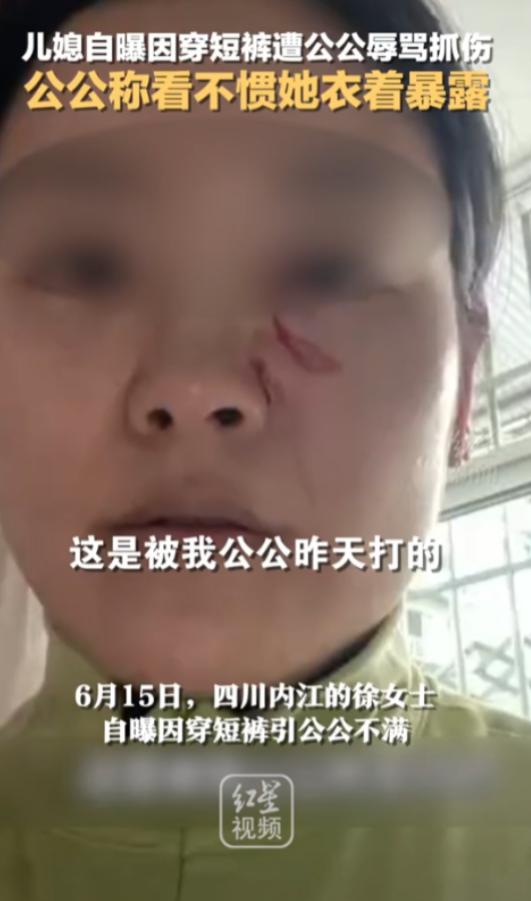 2023年四川，女子觉得天太热，就在家穿清凉小短裤。岂料与公婆吃饭时，公公盯着看