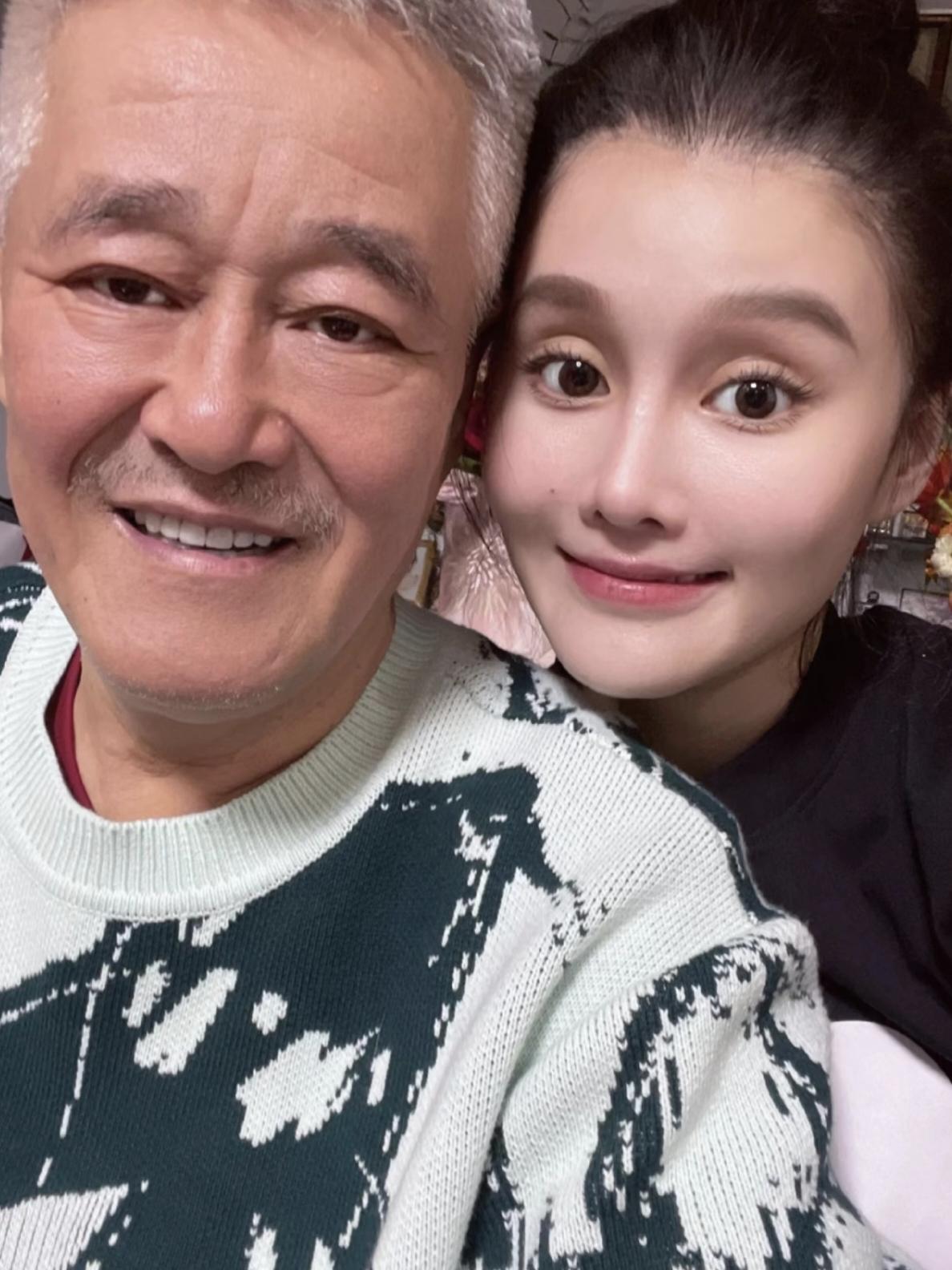 赵本山女儿自曝隆鼻后遗症，30万假体经常发红。赵本山女儿球球在直播间，大方承
