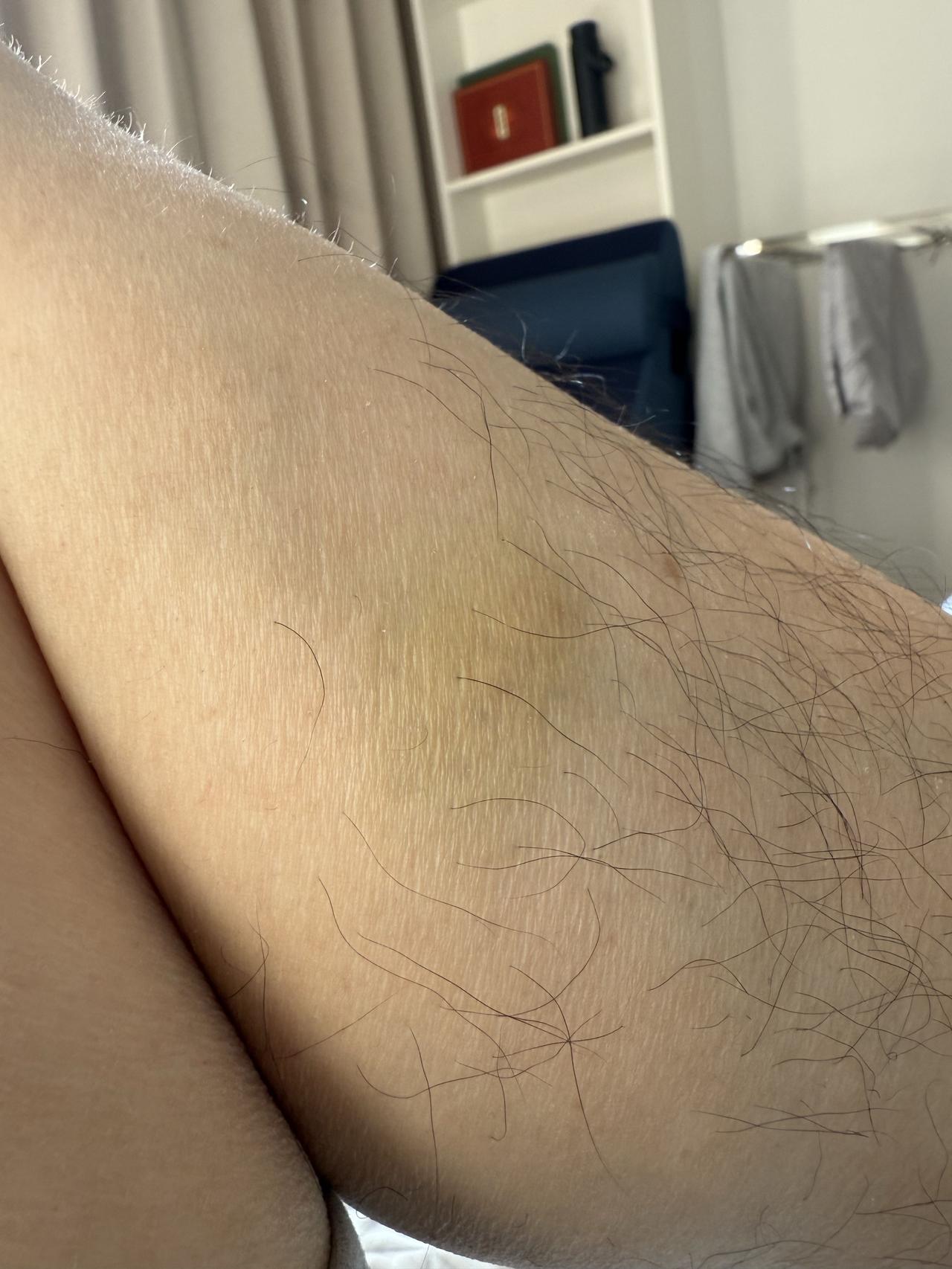 老婆又变卦了，说明天早上高开的话，要我把股票卖了。我不同意，她居然踢我，大腿都被