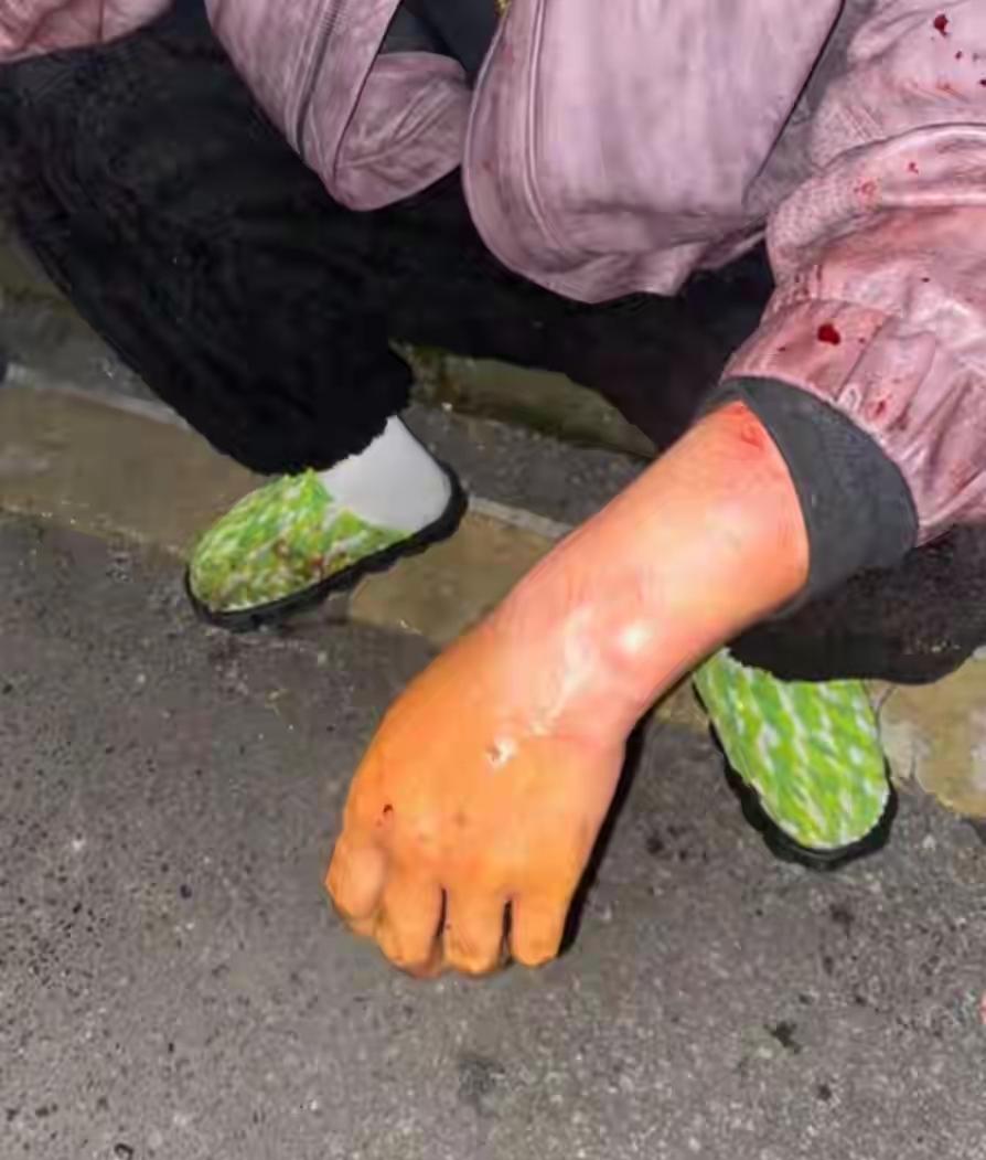 “知道给自己带口罩，怎么不给自己狗带嘴套，是你自己害死papi的”，北京的李女士